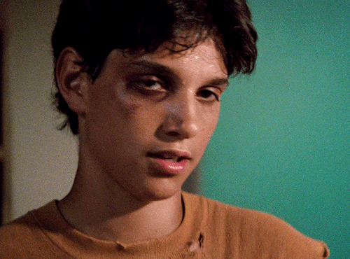 Him All Beat Up>>>