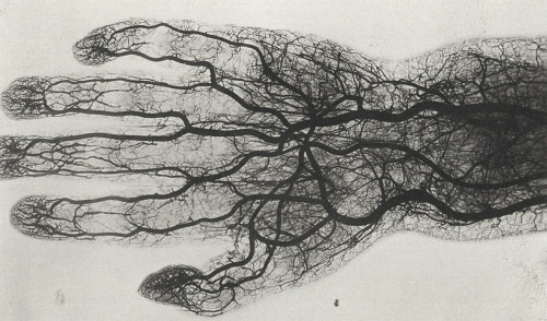 Unknown Photographer, Hand Of A Child, Image Plate Form: Das Arteriensystem Des Menschen Im Stereoskopischen
