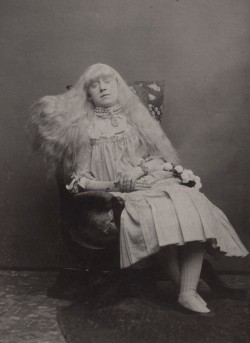 carolathhabsburg:  Albino girl. Late 1890s.