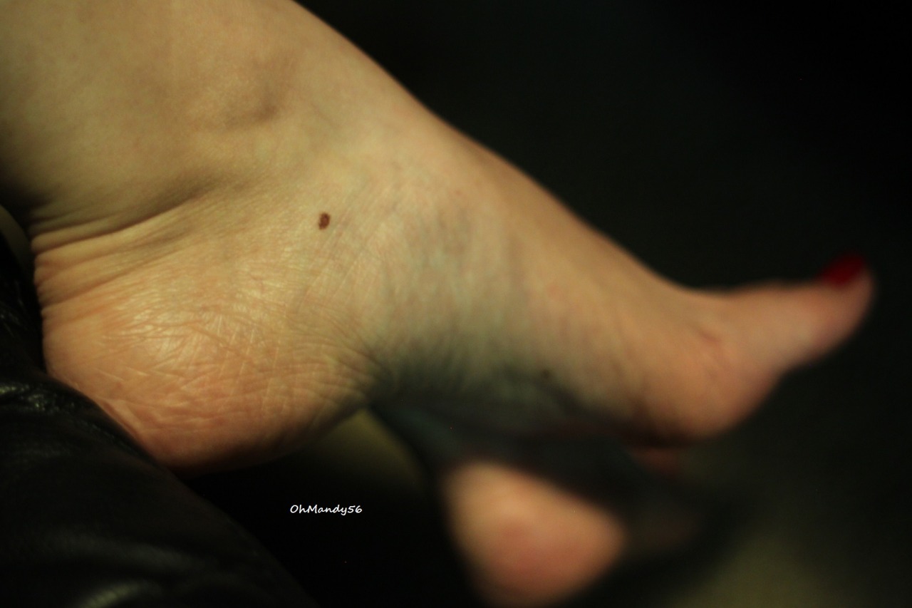 ohmandy56:  There’s a big interest in skin texture.  So, here are skin &amp;