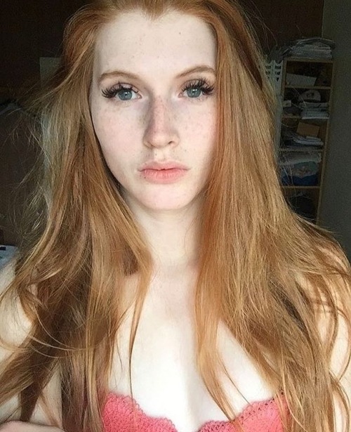 redhairzz:@weasley.chiara Tolle Sommersprossen