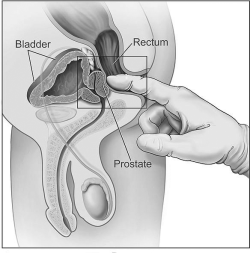 puromachomx:  MEN’S G-SPOT DO YOU KNOW WHERE IT IS LOCATED AND HOW TO STIMULATE IT!?  The G-Spot or Sacred Spot of a man is his prostate gland. Tantric philosophy considers the G-Spot a man’s emotional sex center. Massaging the man’s prostate releases