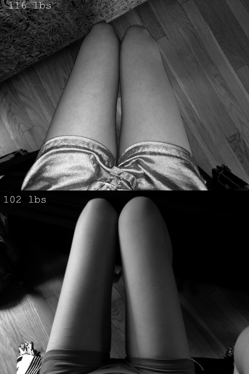 wasted-years-of-life:   x 