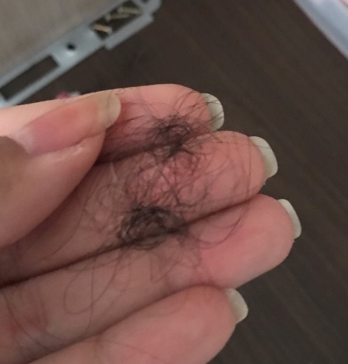 Como Eu Fao Pra No Ter Queda Severa Do Cabelo Por Conta Do T.a: