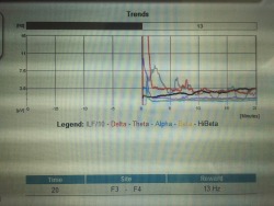 After 20 minutes of neurofeedback training. Such a significant difference from 0-20 minutes.