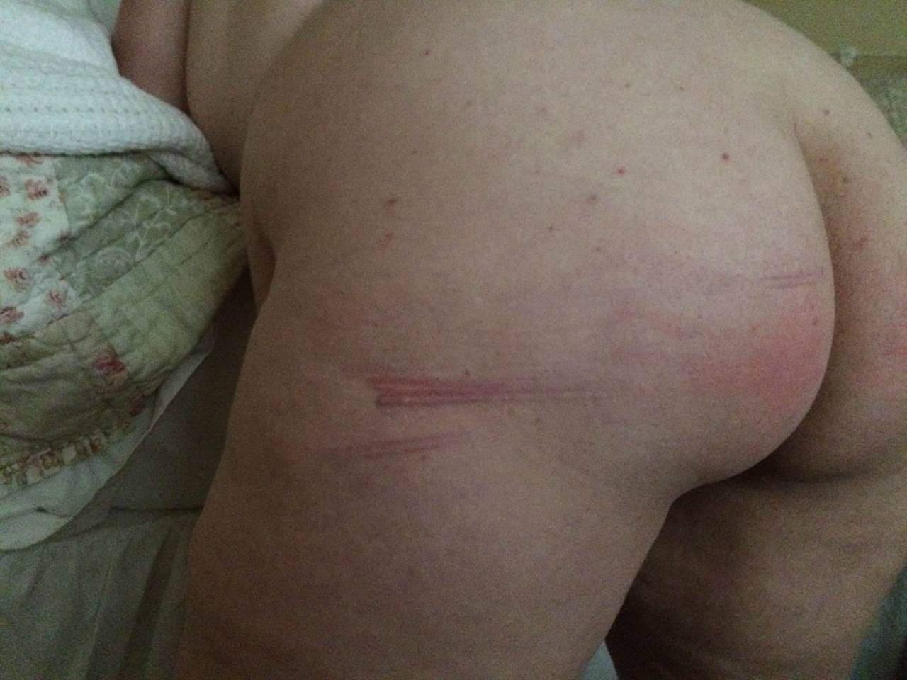 scarletslutmolly:  Birthday caning, Part 1. This was after 9 hard strokes…I told