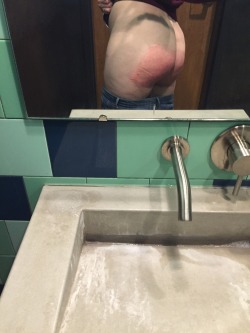 My butt one and two hours after my Real Spankings