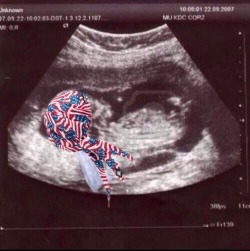 im-a-potato-fuck-you:  &ldquo;Is it a boy or a girl?&rdquo; *sheds a single tear* *whispers* &ldquo;It’s an American&rdquo; *bald eagle screeches in the distance* 