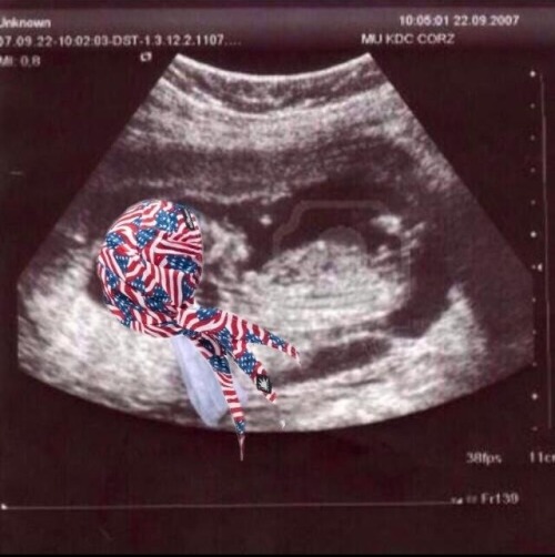 im-a-potato-fuck-you:  “Is it a boy or a girl?” *sheds a single tear* *whispers* “It’s an American” *bald eagle screeches in the distance* 