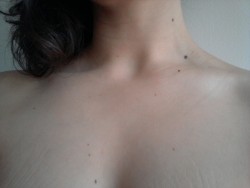 suckmyclicks:  Everyday I find a new mole on my body; when I was a kid I used to hate my moles and asked my mom constantly to make them disappeared, she told me she couldn’t do anything because that’s how nature works and that I should feel unique