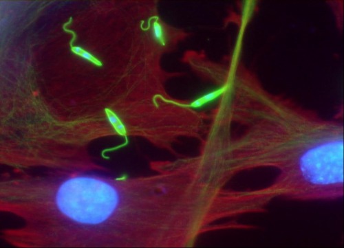 Leishmania major promastiotes during infection of primary fibroblast culture. Cells are stained with