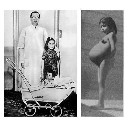 welcometothe1jungle:  Lina Medina officially became the youngest confirmed mother in medical history, aged five years, seven months and 21 days. The doctors who worked on Lina noted that she had an abnormal advancement in growth, with prominent breast