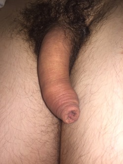 withoutclothing:  Here’s a submission of a penis snaking down a thigh.  Fuck it needs a circumcision