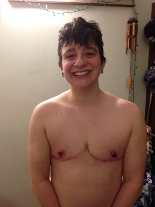 skwagger:Here’s some body positivity for Trans Day of Visibility. I never thought I’d EV