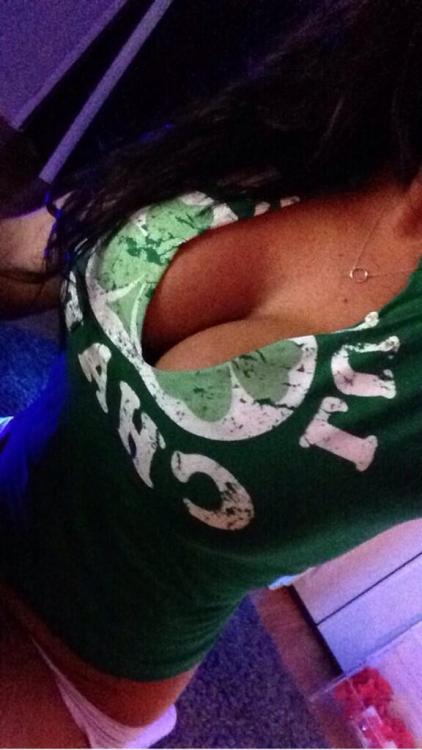 amateur-implant-pics:  Kerington Cruz 