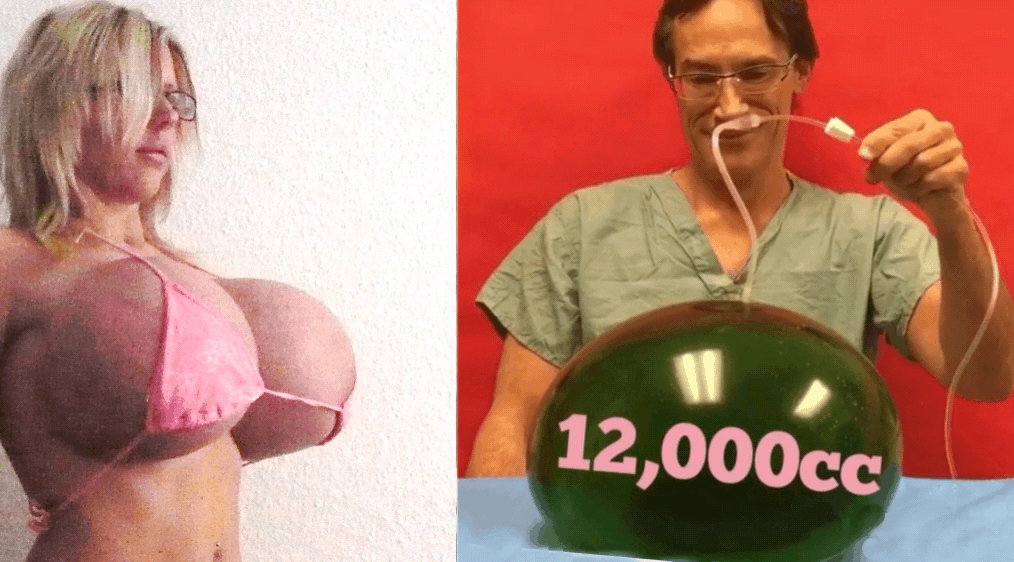 crashbimbofication:  If your implants are this big, then maybe, *possibly*, we could