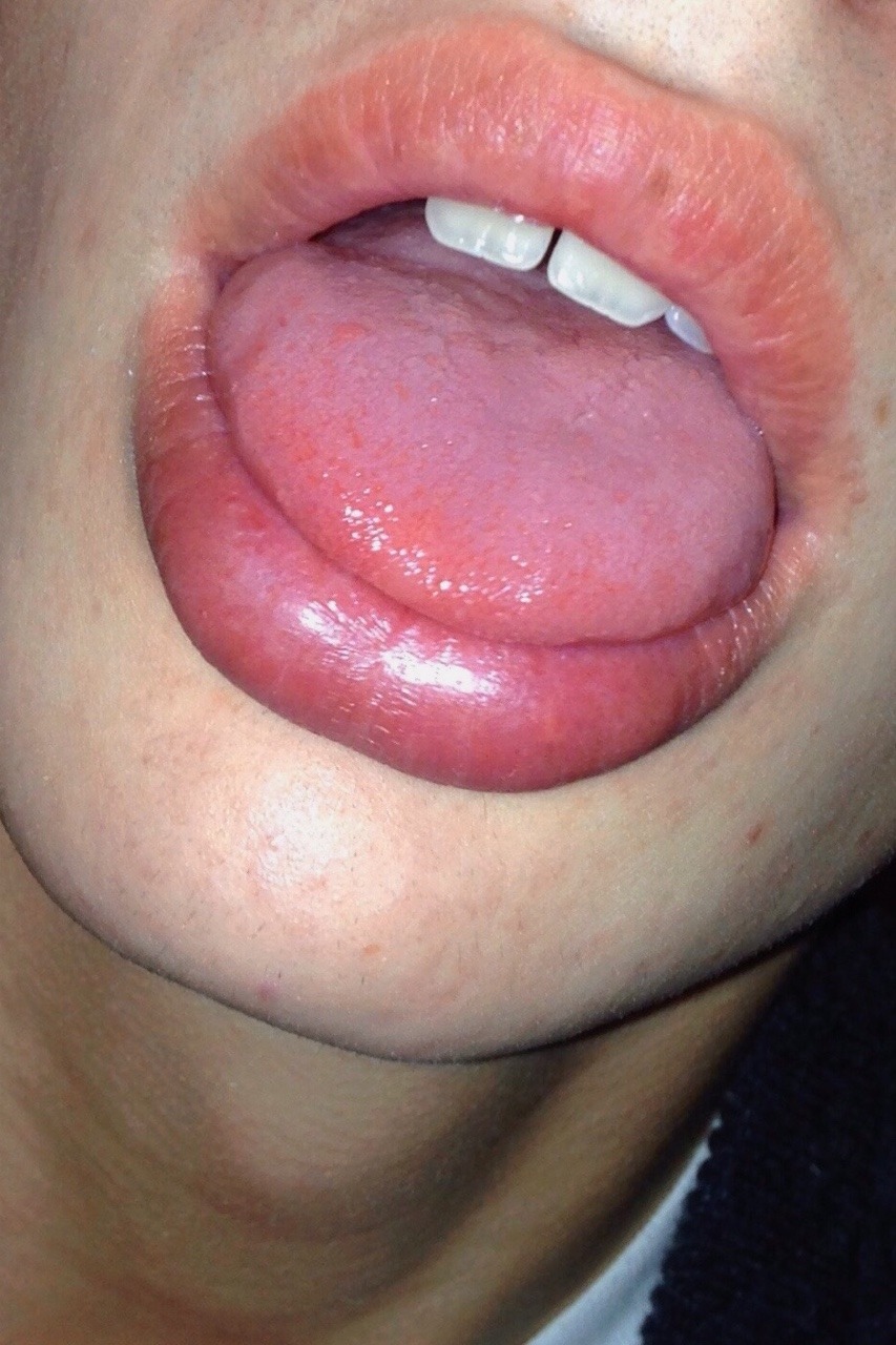 e-hoe:  the only part of my body i like 