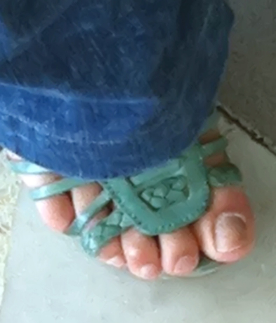 fan-feet:  #Toes and #Arch