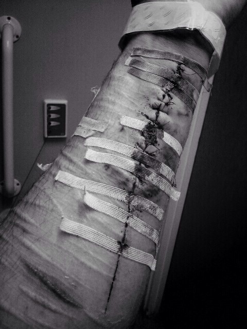 Destructive Disaster.