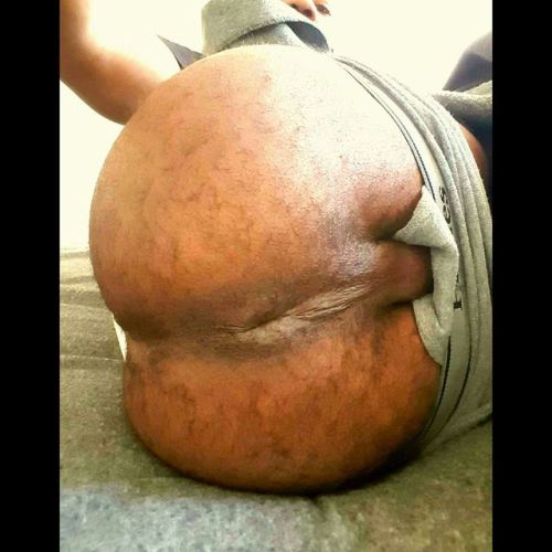 phreshdope069:  Buttholes and buttcheeks 😍😍  Follow phreshdope069  Kik mightymaximum