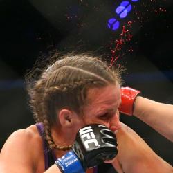 thekaratekidblog:  The danger of “cauliflower ear”. Leslie Smith’s ear explodes after a direct hit by Jessica Eye at UFC 180. 