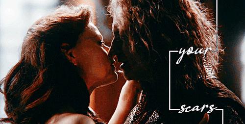 "And Love Is When Someone Who Even Knows Your Scars, Stays To Kiss Them." - Benjamin Griss