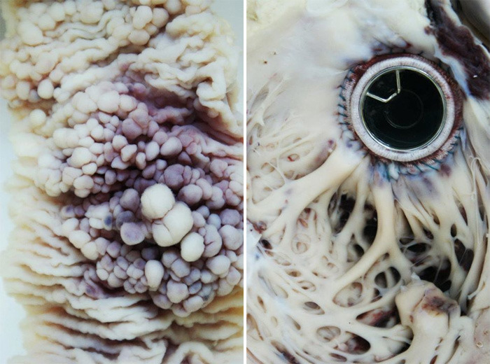 mai-art:   Mia Jane-Harris creates absolutely stunning close-up photographs of medical