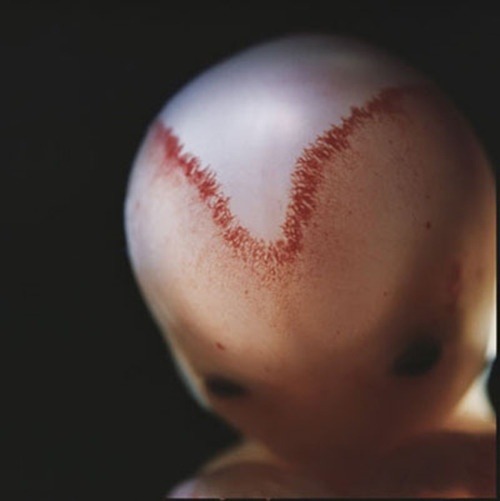 Blood vessels show where the two skull bones are fusing in a 9-week-old fetus.