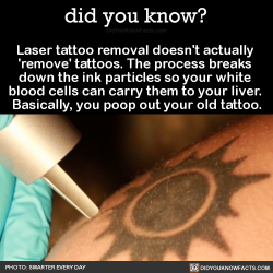did-you-kno:  Laser tattoo removal doesn’t
