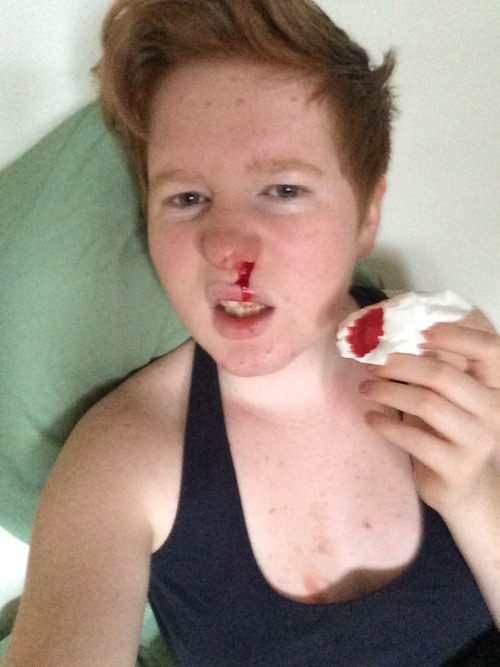 aw yeah. im tough. and sick. but I’d rather pretend I was in a fight than admit that I made my