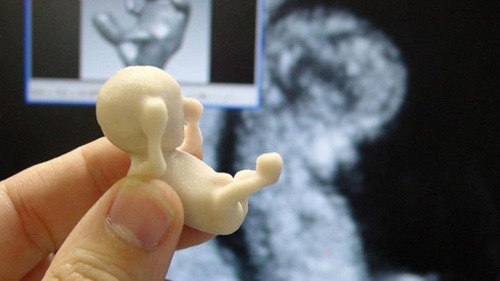 the-forward-observer:  pringlesninja21:  life-gift-love-eternal:  the-forward-observer:  3d printing can be used to print sonograms i.e. life size developing babies. These 3D sonograms are used to help blind expectant parents “see” their babies. 