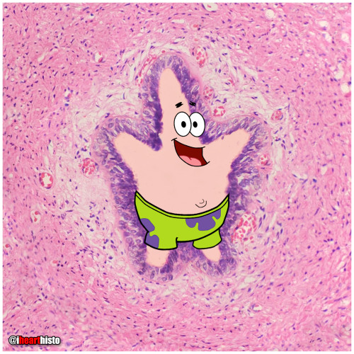  ⭐ Patrick Star in a Sperm Tube My favorite Patrick in honor of #stpaddysday☘️ Some say that Patrick