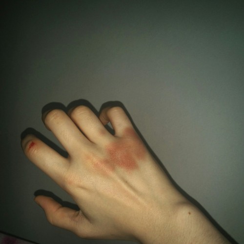 #bruised-knuckles on Tumblr
