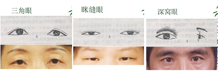 exrpan:  mirrepp:  14 Different kinds of asian eye shapes.  I’m so glad someone