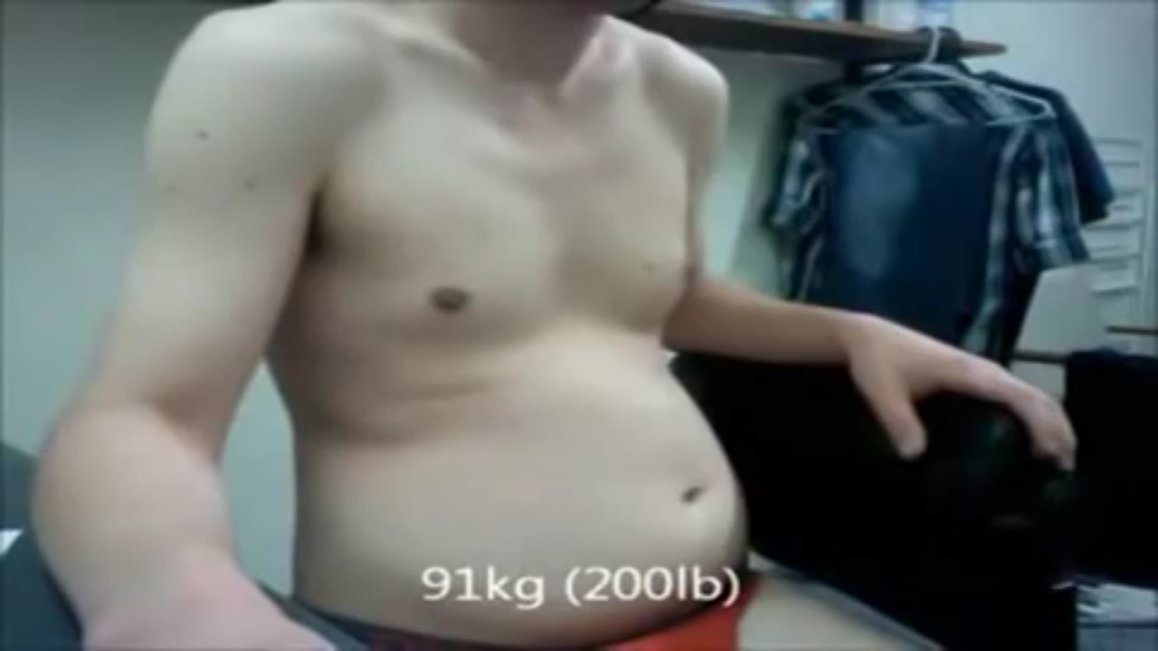 blogartus: admirer88888:  Dude apparently gained 110 pounds quite rapidly.  https://youtu.be/SgB0AySm-SU