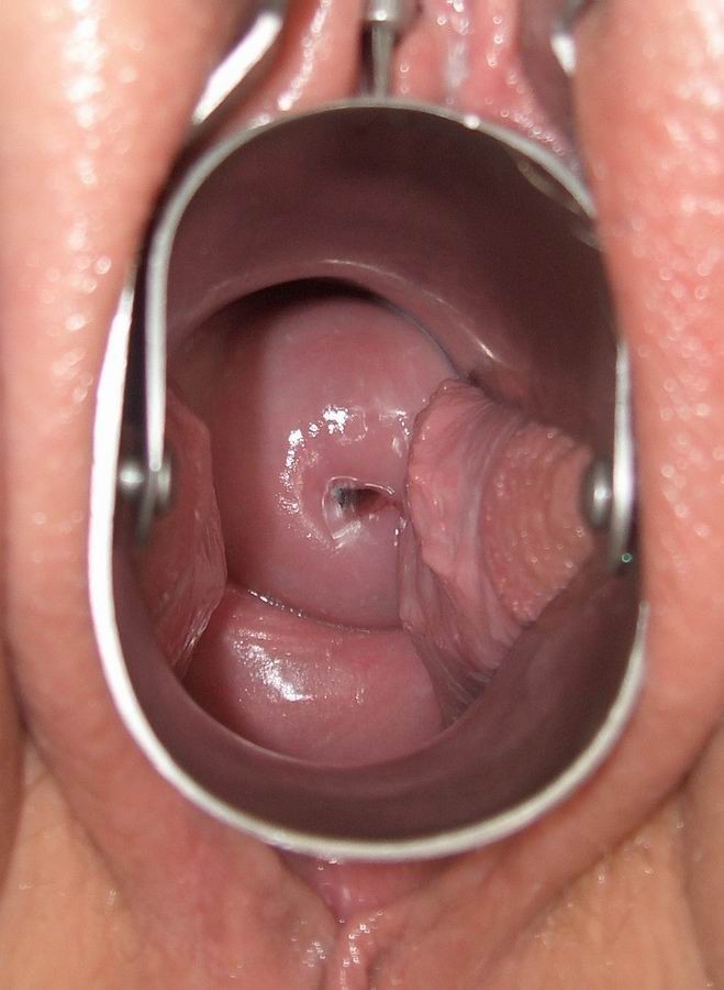 Gaping pussy speculum