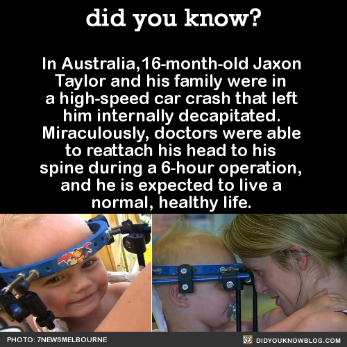 did-you-kno:  Jaxon’s collarbone and C1 and C2 vertebrae were all broken. Doctors used one of his ribs to graft the two vertebrae together.He is expected to spend 8 weeks in his “halo” neck brace to allow his nerves and tissues to heal, but he is