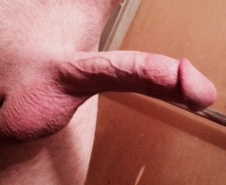 submit-your-penis:  What do you think?  Really needs attention! Wife isn’t interested!
