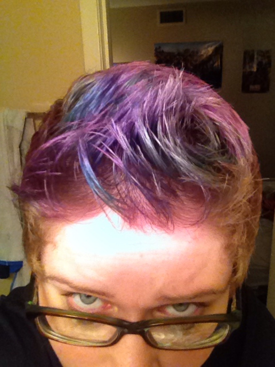 chlorogirl:  Just a quick hair update: it’s growing slow as fuck, but I’ve augmented