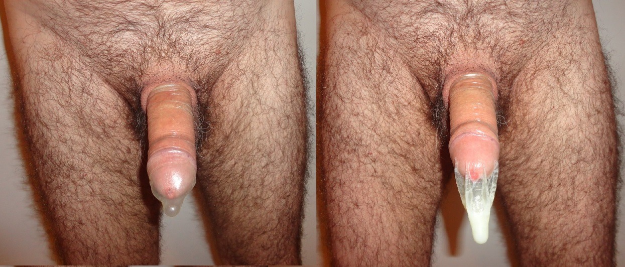 condom before and after