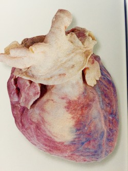 madradiohead:  hearts are the most gorgeous organs 