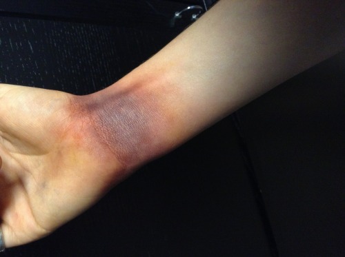fragile-happiness:  Ooooops  D, let’s get this to happen to me. You know how I love bruises. -T
