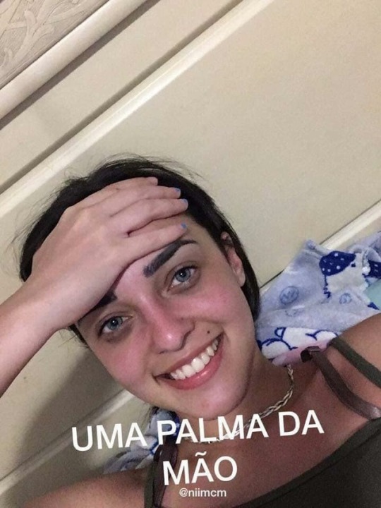 seu-bobo-da-corte:  os outros antes: nossa mas sua testa eh enorme *eu indo chora em posição fetal*os outros hoje: nossa mas sua testa eh enormeeu: QUERIDO VC N VIU NADAAAA