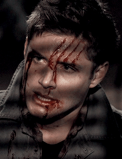 dustydreamsanddirtyscars: #DEAN APPRECIATION WEEKSUNDAY: A Set Dedicated to Dean // Bruised, Bloody and Still Utterly Beautiful
