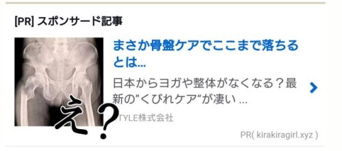 yoshimuraspeed:  ねむさんのツイート: “骨盤ケアとかくびれ以前に右の大腿骨折れてるからな💢適当な写真使ってんじゃねーぞ💢… ”
