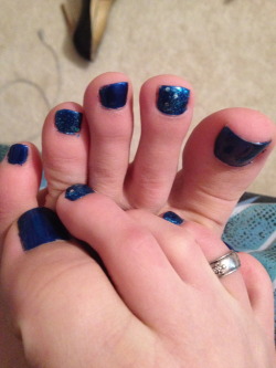 misswrinkles:  My ever popular Blue Toe Nail