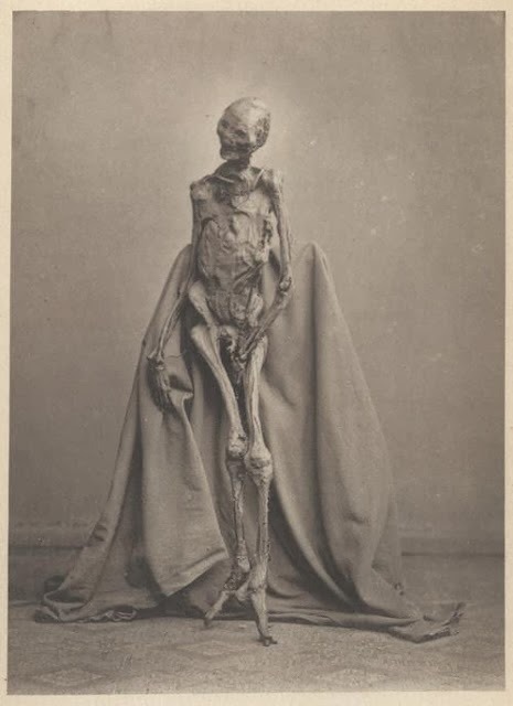 solutreanfloridian:  the-end-0f-summer:  Photograph from 1873 of a body preserved in a bog. The body had been found in 1871 in the Heidmoor near de:Rendswühren and is now on display at Gottorf Castle, Schleswig Germany. Dated around 1st or 2nd century