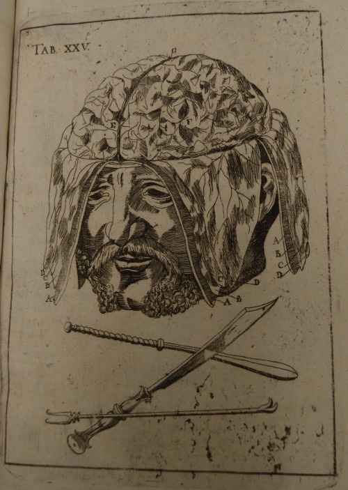 Brains are zombies’ delicacy of choice, and this woodcut from Antonius Novarinus’s Anatomia Curiosa 