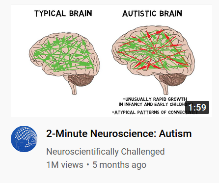 landsword:buchanka:a typical brain is small and only has green arrows in it whilst an autistic brain is big and has both green and red arrows   glad we’re all on the same page
