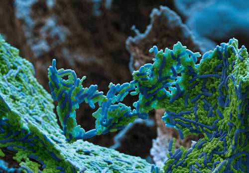 staceythinx:Some of the fascinating images from the Kuriositas gallery Under the Electron Microscope